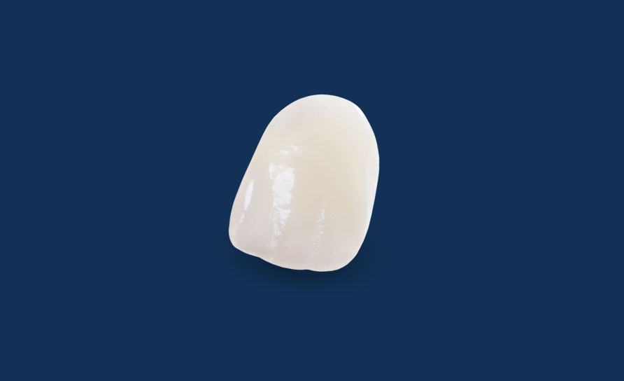 IPS e.max® Dental Restorations